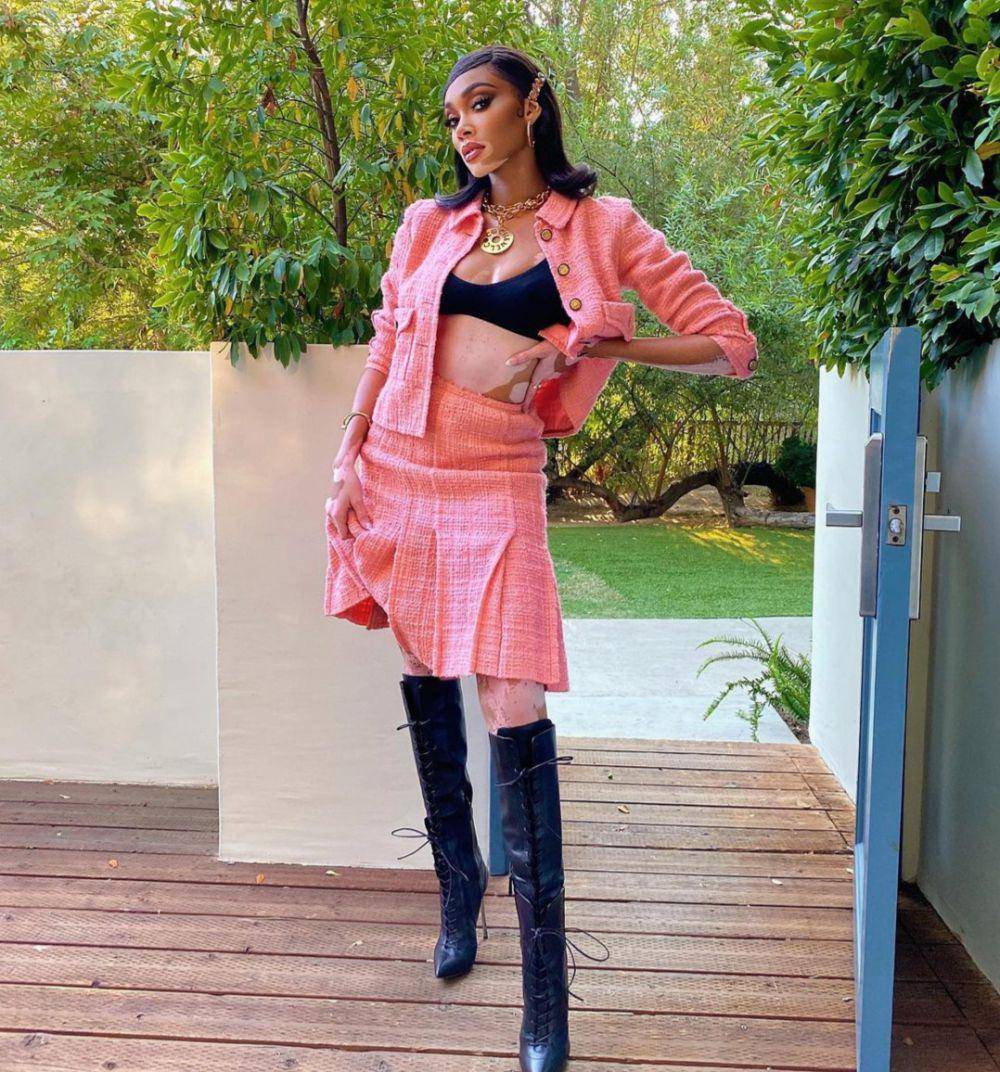 Winnie Harlow (instagram.com/winnieharlow)
