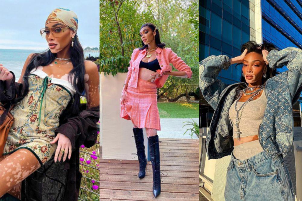 9 Inspirasi Outfit ala Winnie Harlow, Ada Look Kasual hingga Formal!