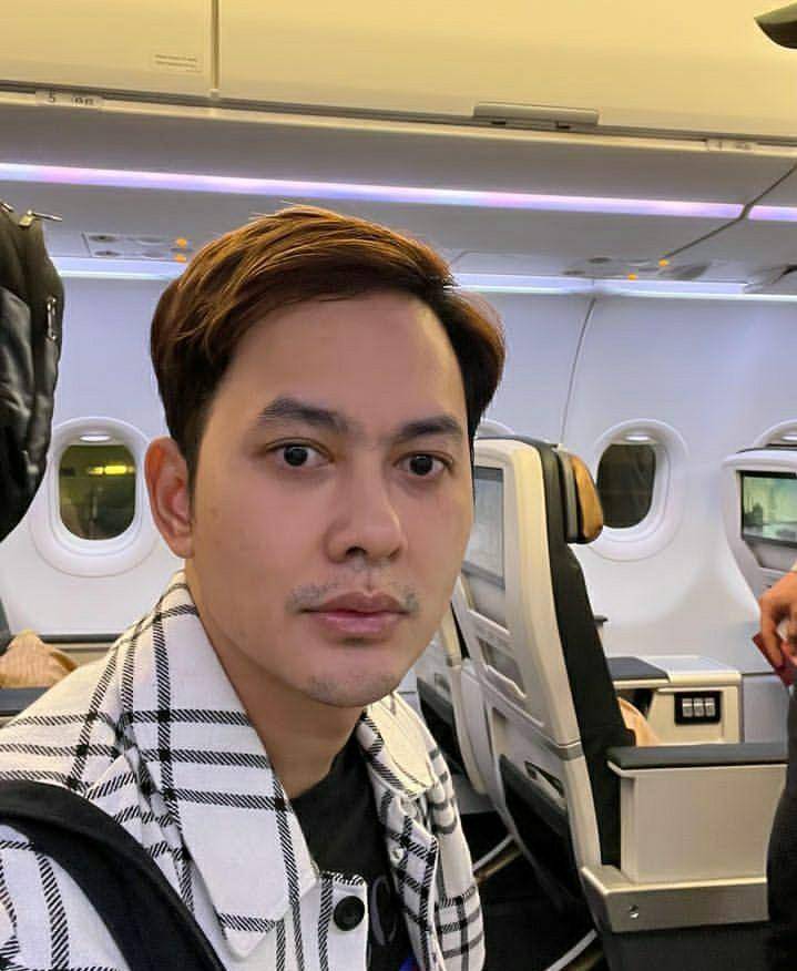 potret Kiki Farrel jalani operasi transplantasi rambut di Turki (instagram.com/kikifarrel_)