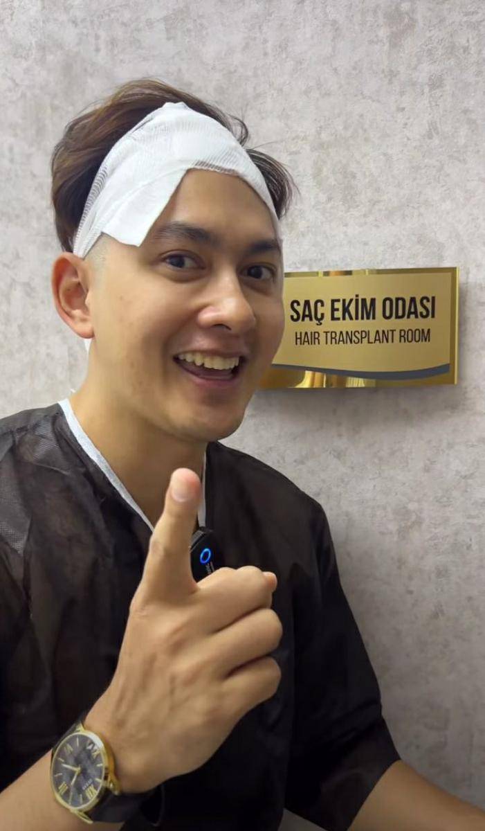 potret Kiki Farrel jalani operasi transplantasi rambut di Turki (instagram.com/kikifarrel_)