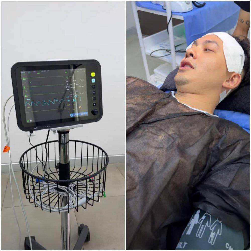 potret Kiki Farrel jalani operasi transplantasi rambut di Turki (instagram.com/kikifarrel_)