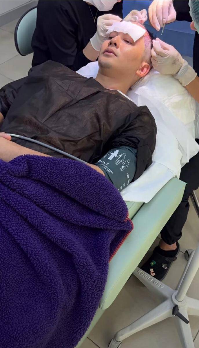 potret Kiki Farrel jalani operasi transplantasi rambut di Turki (instagram.com/kikifarrel_)