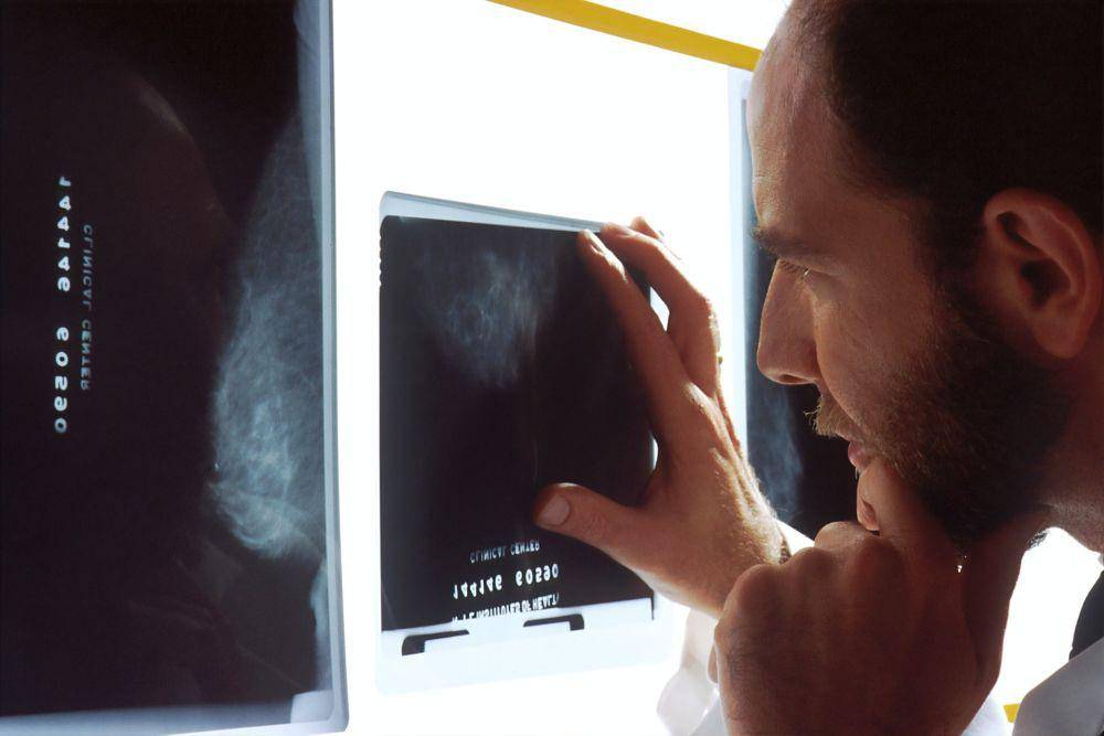 ilustrasi diagnosis kanker prostat (unsplash.com/National Cancer Institute)