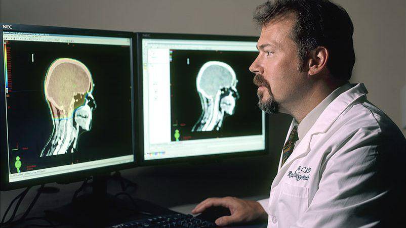 ilustrasi seorang dokter pria sedang meninjau gambar otak dalam perencanaan dosimetri terapi radiasi terkait tumor otak (commons.wikimedia.org/National Cancer Institute/Rhoda Baer)