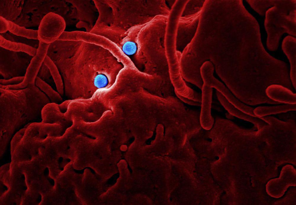 Tak Selalu Menimbulkan Penyakit, 10 Virus Ini Beri Dampak Baik