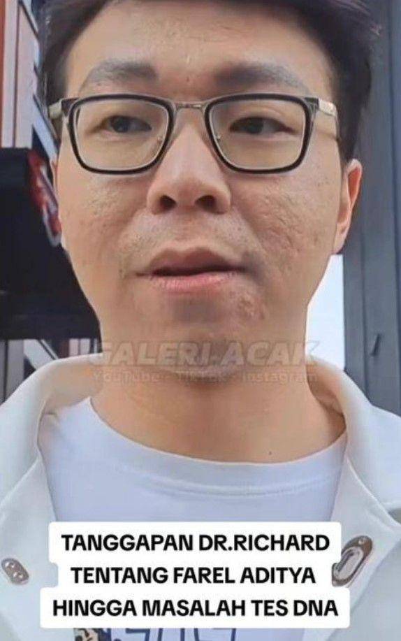 jawaban Richard Lee wajahnya dinyinyirin netizen (tiktok.com/@galeri.acak)