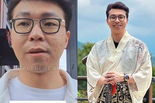 Jawaban Richard Lee Usai Wajah Aslinya Dinyinyirin Netizen: Itu Aku