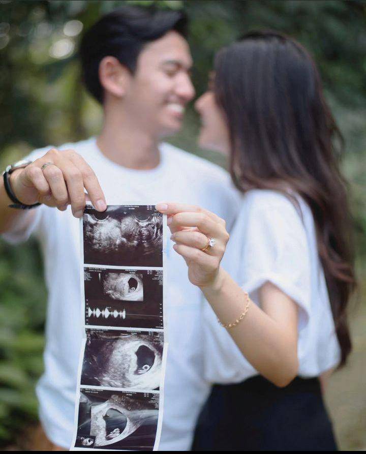 Sabrina Anggraini umumkan kehamilan (Instagram.com/belvadevara)