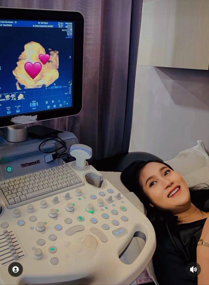 Perjalanan kehamilan hingga lahiran Yeni Inka (Instagram.com/yeniinka)