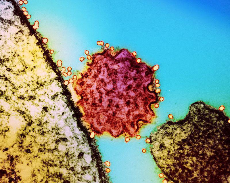 Asal-usul Nama Virus Nipah, Menarik untuk Diketahui
