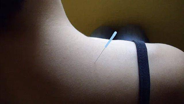 Titik GB21 (acupunctureturningpoint.ca)