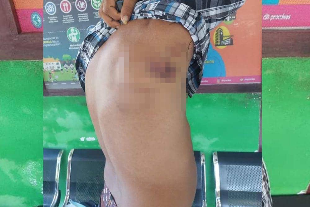 Seorang kapten kapal bernama Alprens Harimisa (45) yang dianiaya anggota Satgas Gakkumla Lantamal VIII Manado pada Rabu (4/10/2023). IDNTimes/Istimewa