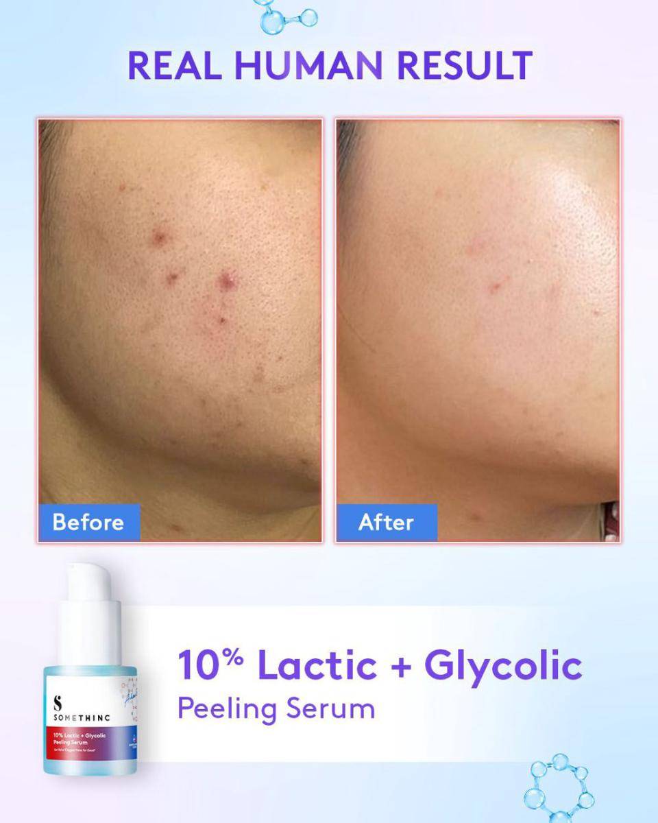 potret serum terbaru Somethinc (dok. Somethinc Official)