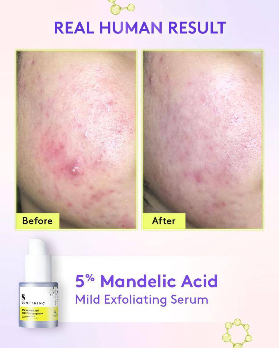 potret serum terbaru Somethinc (dok. Somethinc Official)