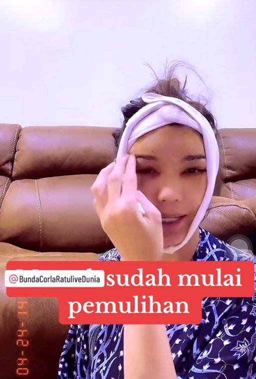 Bunda Corla operasi plastik (TikTok.com/fadiqmaksum)