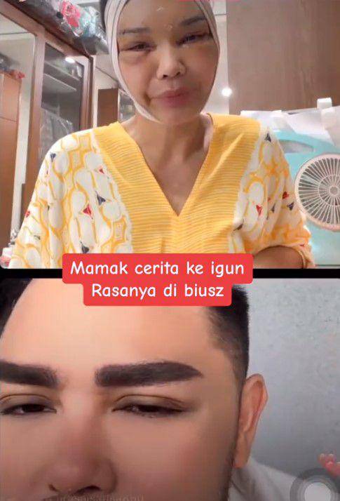 Bunda Corla operasi plastik (TikTok.com/fadiqmaksum)