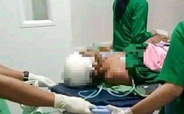 Pelajar di Dompu Dikeroyok hingga Tengkorak Kepalanya Retak
