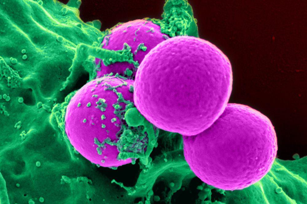 Mengenal Staphylococcus aureus, Bakteri Penyebab Keracunan Makanan