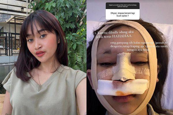 Sering Di-bully, 7 Potret Dhyaz Anak Farida Nurhan Oplas Hidung Lagi