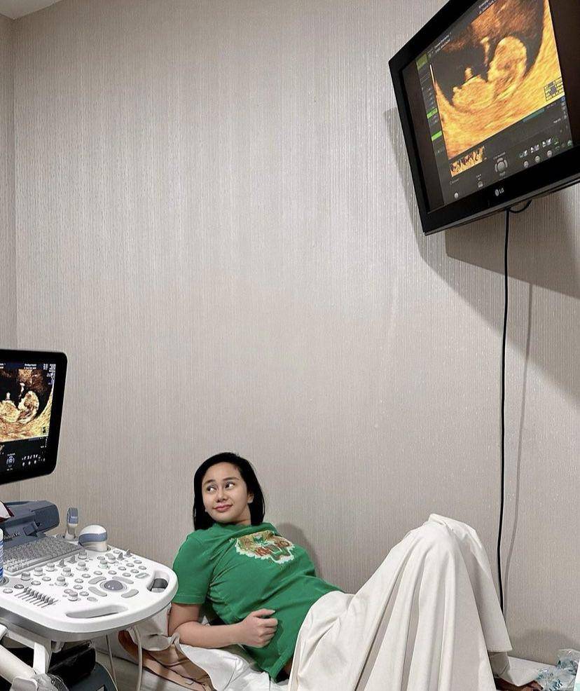 potret perjalanan hamil Denise Chariesta hingga lahiran anak pertama (Instagram.com/denisechariesta91)