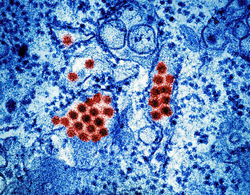 ilustrasi virus dengue di bawah mikroskop (flickr.com/NIAID)
