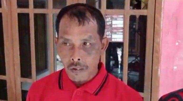 (Korban Darmadi saat menunjukkan lukanya usai dianiaya polisi) IDN Times/istimewa