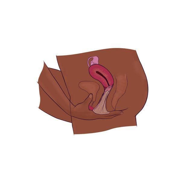 ilustrasi cara pakai kondom perempuan (plannedparenthood.org)