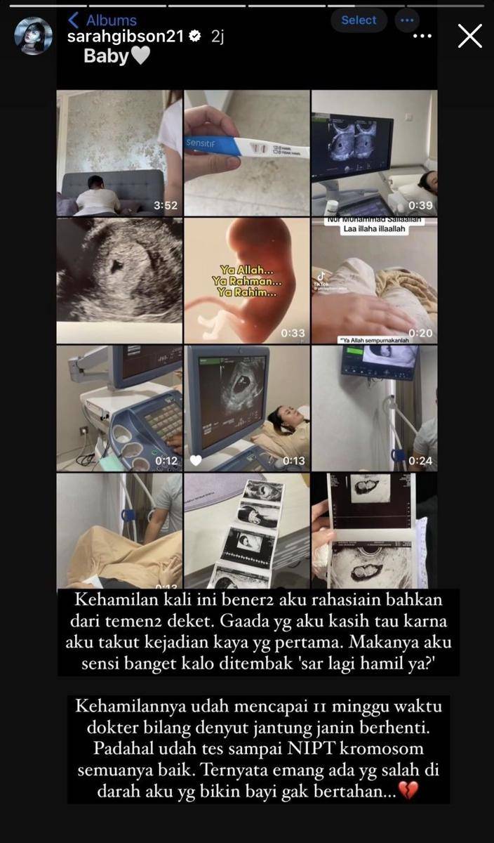 Sarah Gibson keguguran untuk kedua kalinya (Instagram.com/sarahgibson21)
