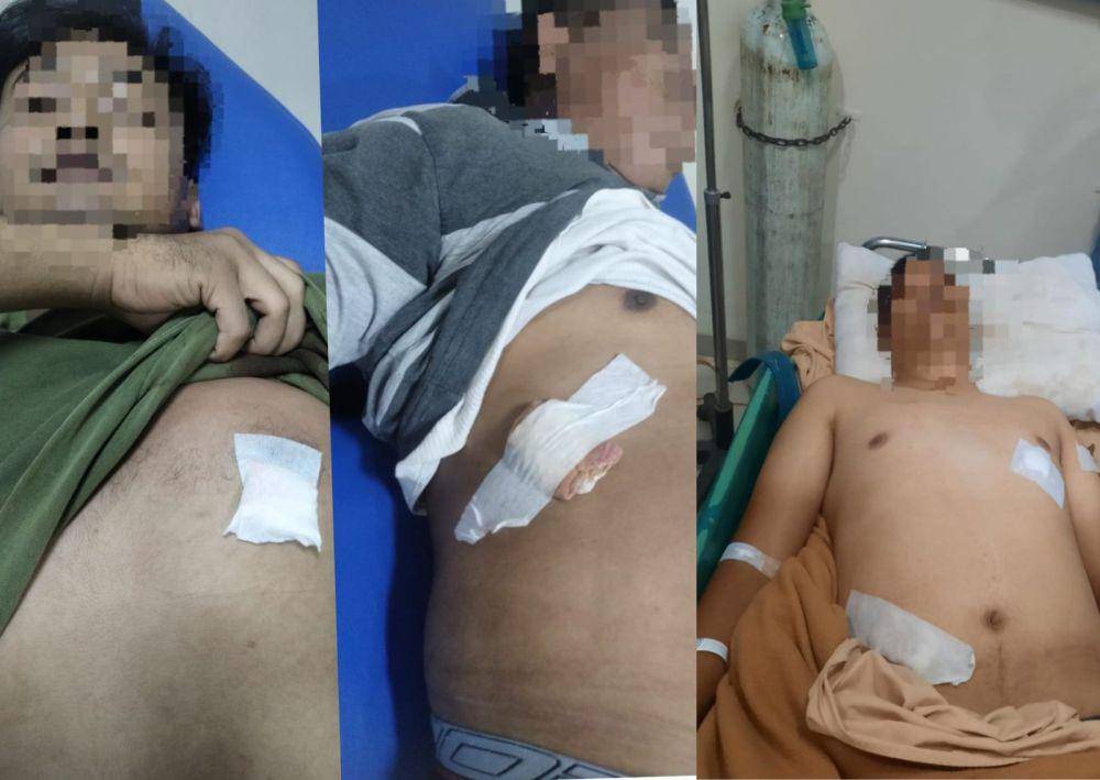 Tiga anggota Polres Muratara alami luka tusuk usai diserang saat penggerebekan arena judi (Dok: Polres Muratara)