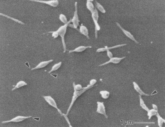 Ilustrasi Mycoplasma pneumoniae (journals.asm.org/ASM Journals Clinical Microbiology Reviews Vol. 17, No. 4)