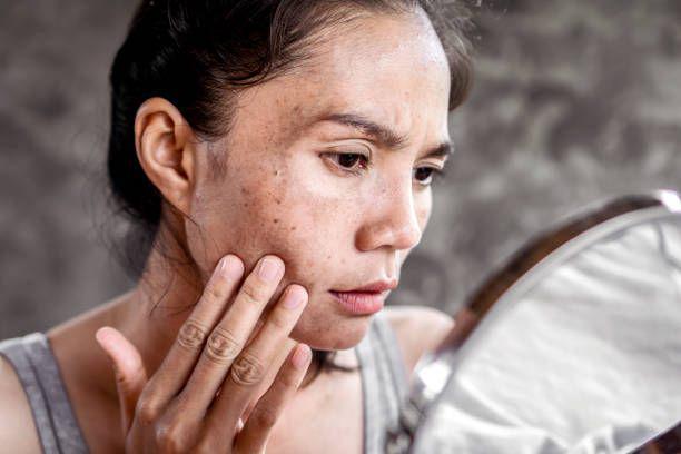 5 Kebiasaan Buruk yang Bisa Bikin Wajahmu Tampak Lebih Tua