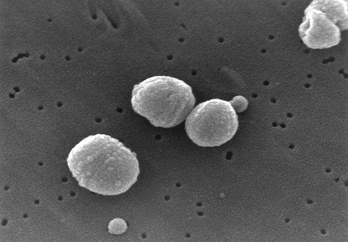 Mikrograf bakteri Streptococcus pneumoniae berbentuk bulat berpasangan, penyebab umum infeksi pneumonia.