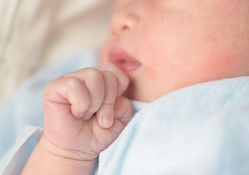 12 Penyebab Ruam Kulit pada Bayi dan Cara Mengatasinya
