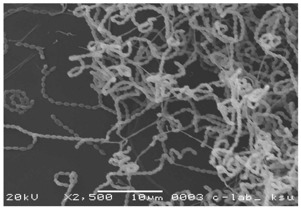 ilustrasi actinomycetes (mdpi.com)