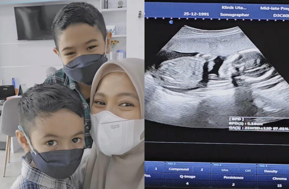 7 Momen Alyssa Soebandono Ungkap Gender Anak Ketiga, Sesuai Harapan!