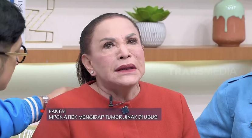 Curhat Mpok Atiek Usai Divonis Idap Tumor di Usus, Gak Mau Dioperasi