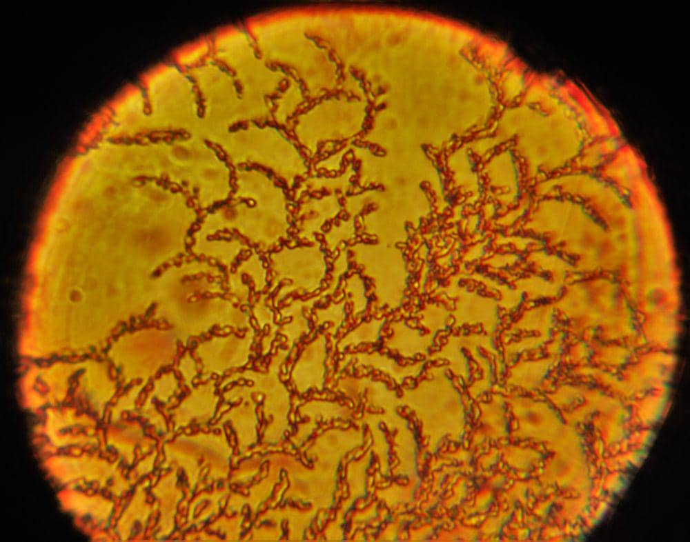 ilustrasi penampakan oksalat di bawah mikroskop (commons.wikimedia.org/Amangeldyurazov)