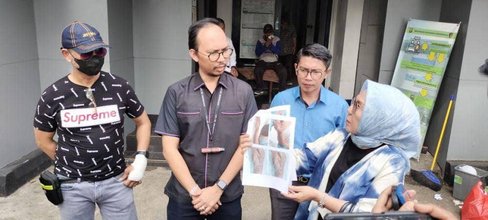 Diduga Alami Malpraktik, Tangan Pria Paruh Baya di Palembang Membusuk