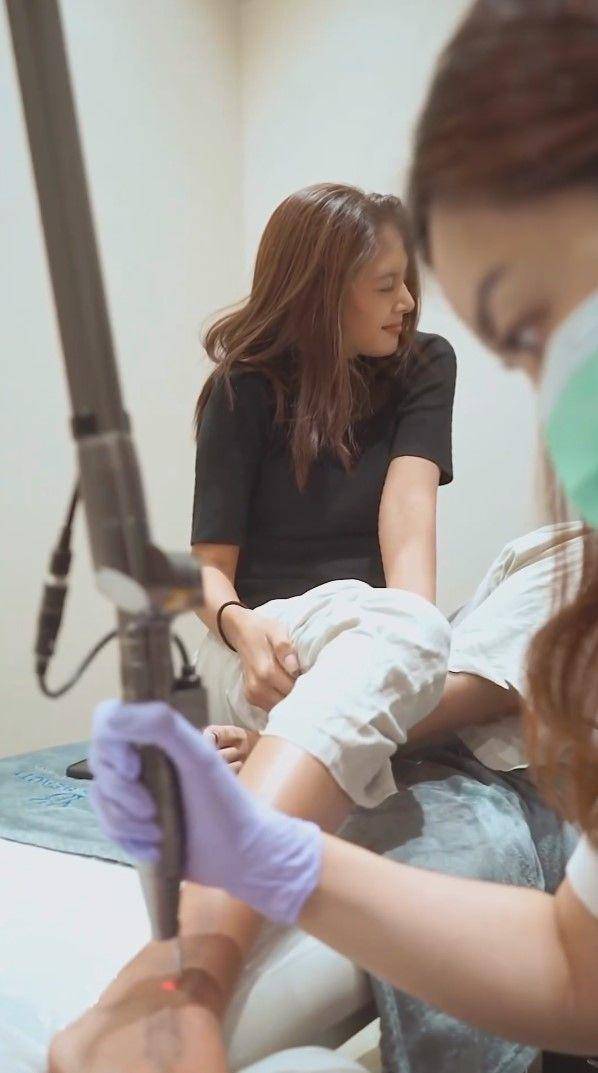 potret Aurelie Moeremans hapus tato (instagram.com/aurelie)