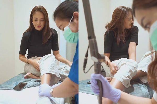 potret Aurelie Moeremans hapus tato (instagram.com/aurelie)