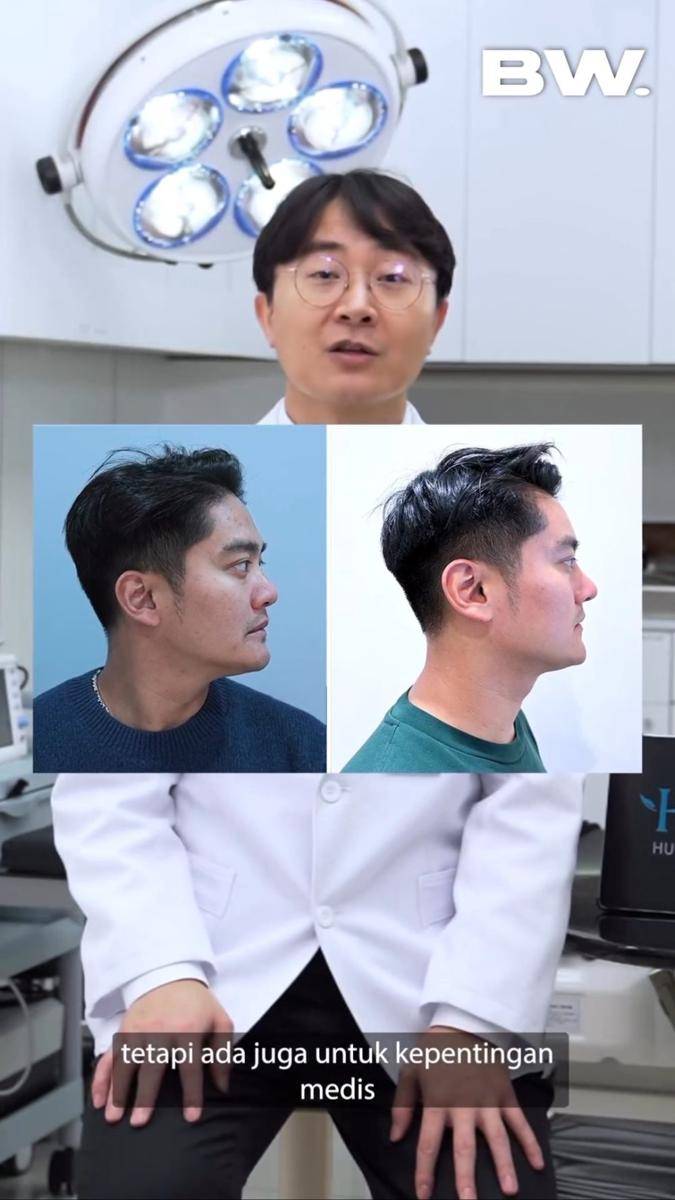 potret Boy William jalani Rhinoplasty (instagram.com/boywilliam17)