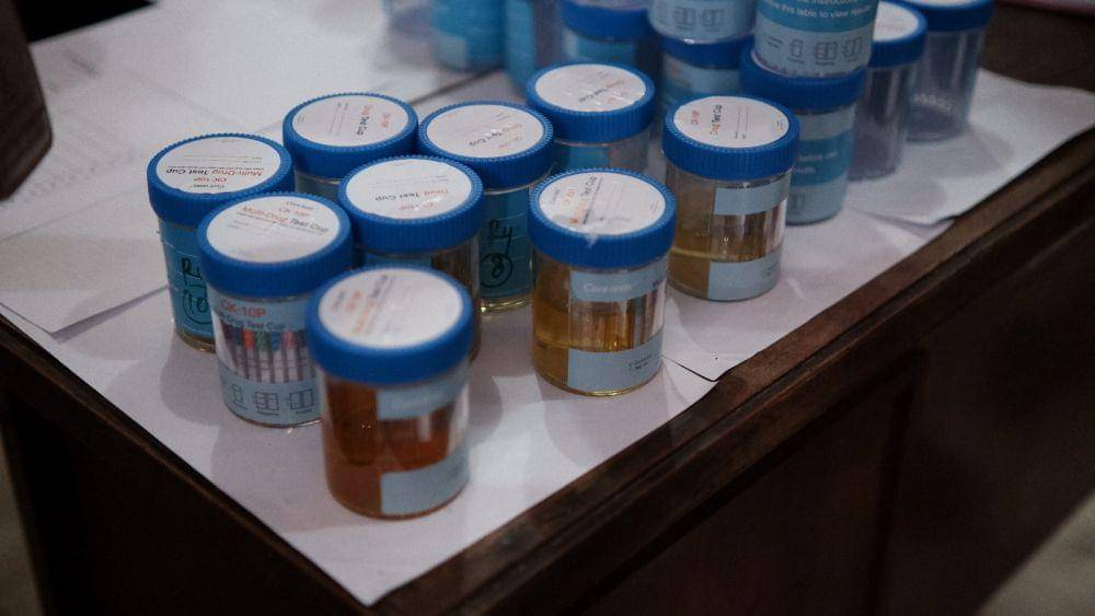 Ilustrasi tes urine (Dok.IDNTimes/Lapas Tabanan)
