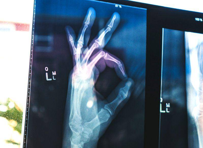 gambar tulang dengan X-ray (unsplash.com/Owen Beard)