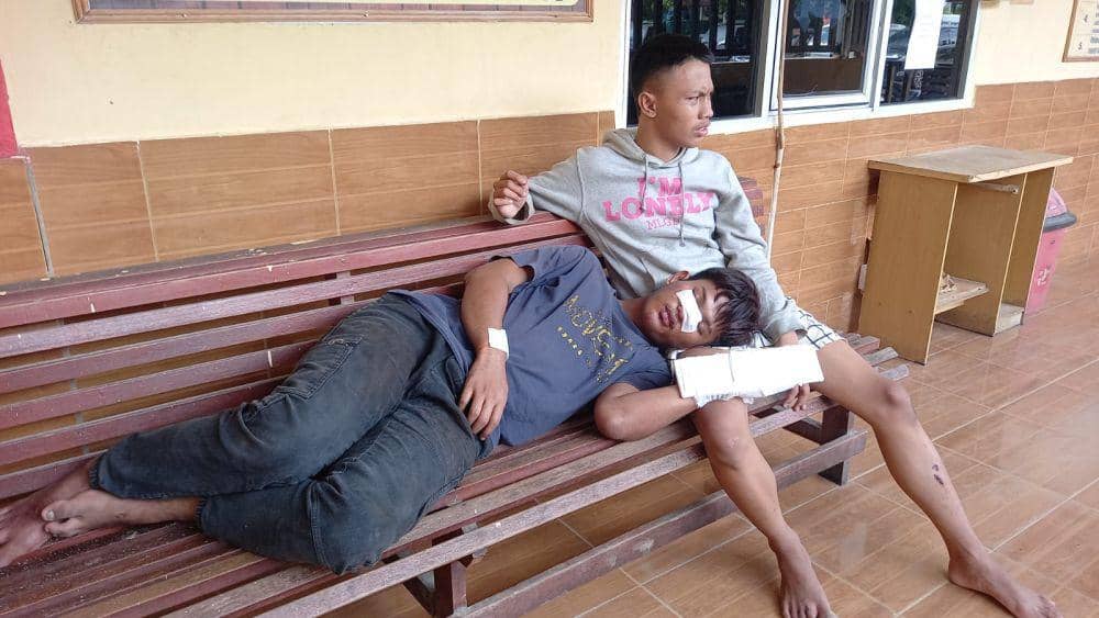 Pemuda di Palembang Dibacok OTD, Tangan dan Hidung Terluka