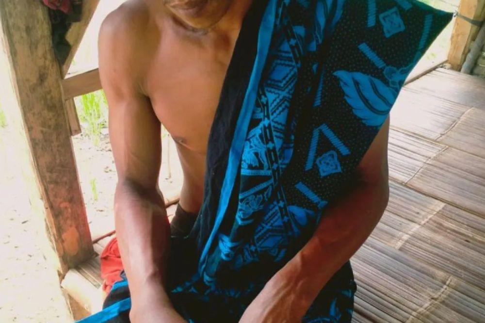 Dipatuk Ular Berbisa, Warga Baduy Dirujuk ke RSUD Banten