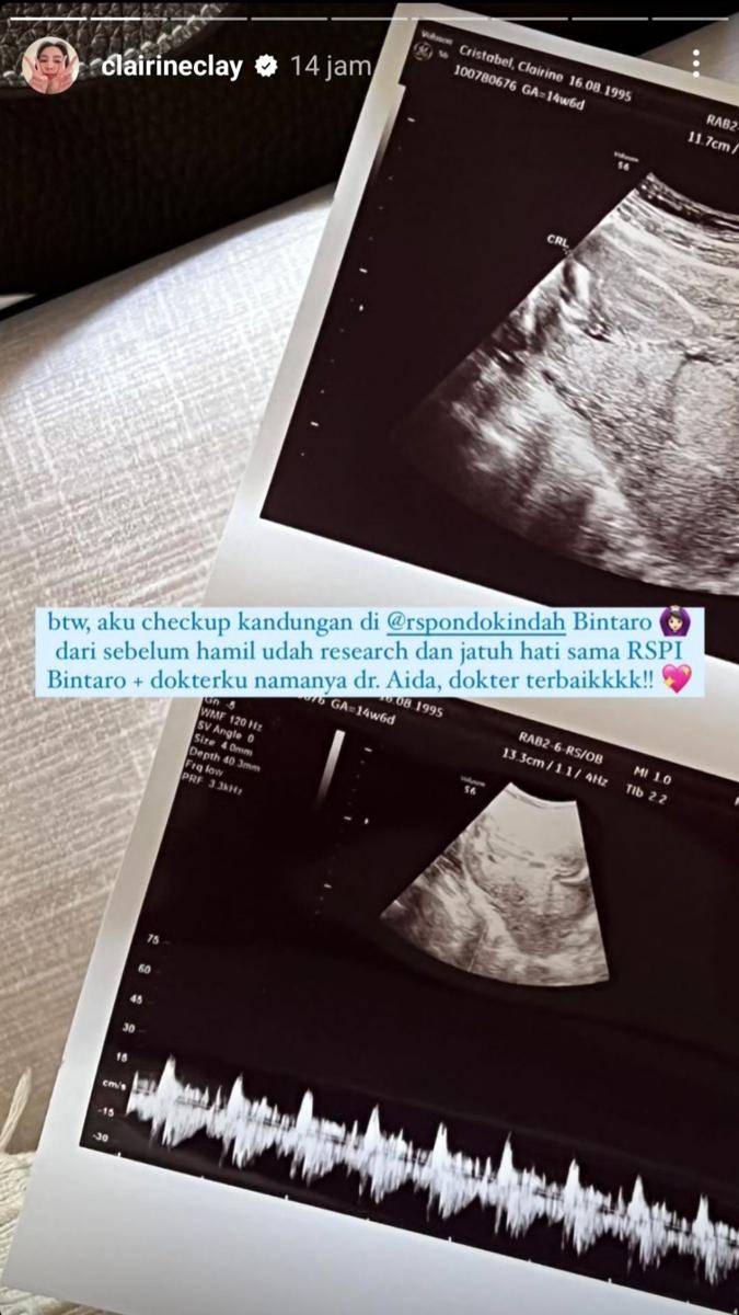 potret Joshua dan Clairine Clay umumkan kehamilan (instagram.com/clairineclay)