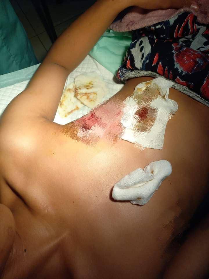 Kondisi korban bullying di salah satu pondok pesantren di Kecamatan Lawang, Kabupaten Malang. (IDN Times/istimewa)