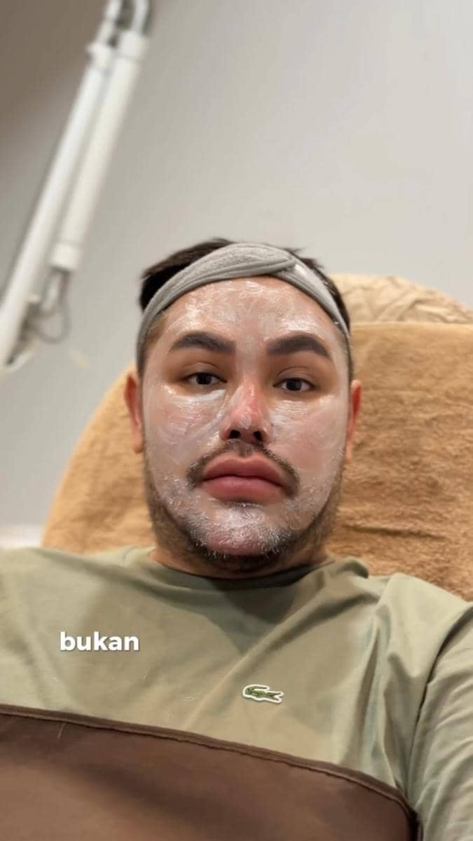 potret Ivan Gunawan jalani treatment tarik benang (instagram.com/ivan_gunawan)