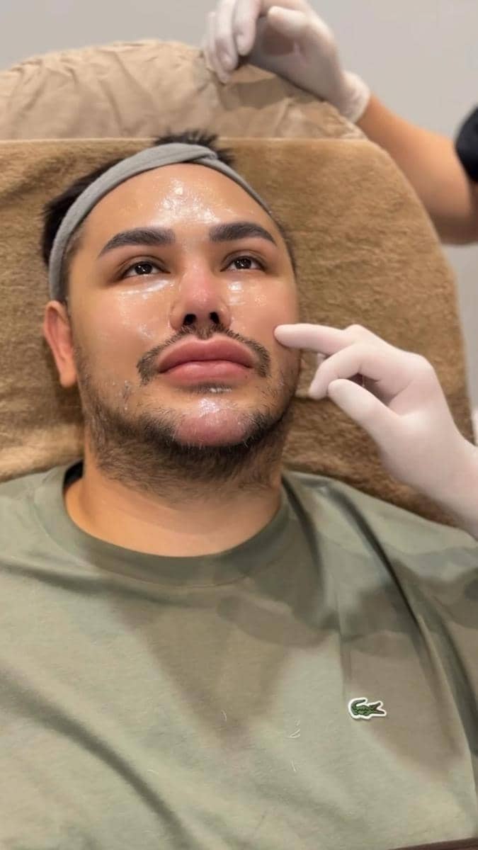 potret Ivan Gunawan jalani treatment tarik benang (instagram.com/ivan_gunawan)