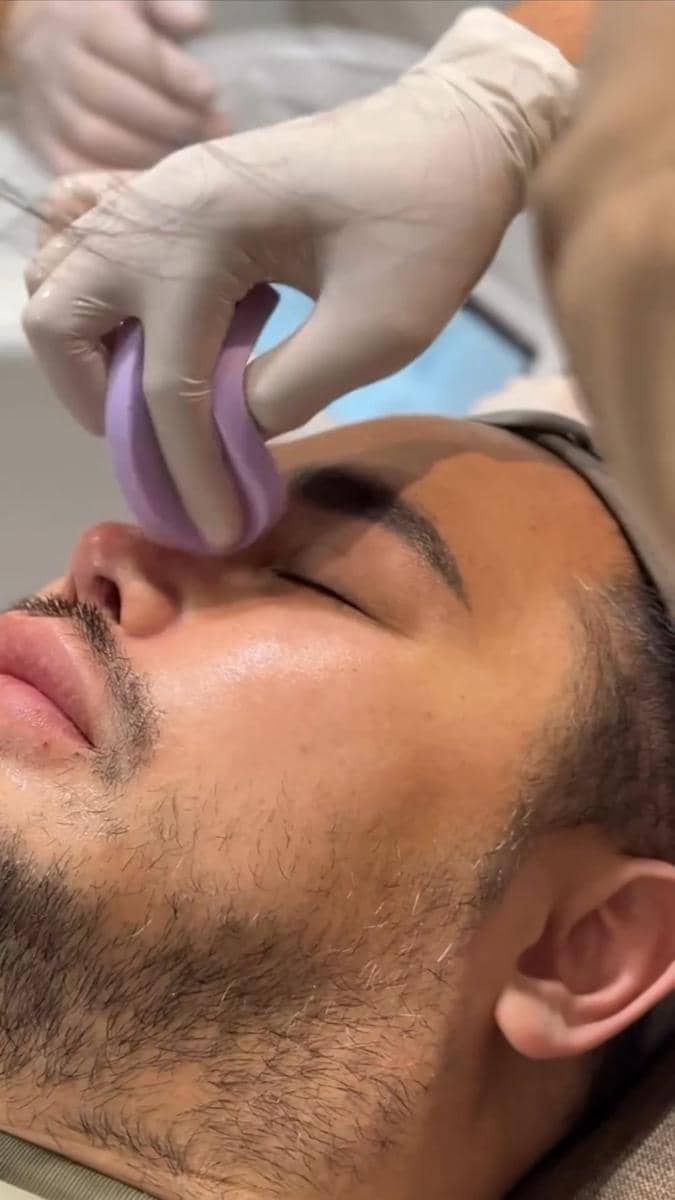 potret Ivan Gunawan jalani treatment tarik benang (instagram.com/ivan_gunawan)